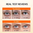 Anti Dark Circle Eye Serum Oil Retinol Anti Wrinkle Firming Skin Remove Eye Bag Fade Fine Line Whitening Brighten Eye Care Korea