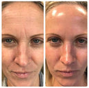 Massageador Facial com Fototerapia Anti-Rugas - GlowUp™